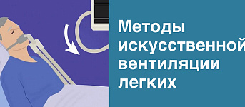 Методы искусственной вентиляции лёгких
