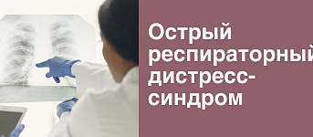 Острый респираторный дистресс-синдром 